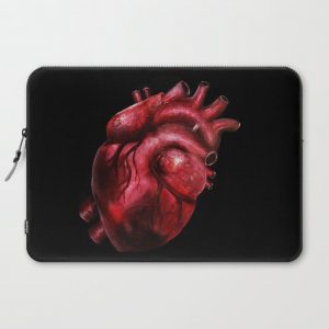 Why I aorta (II) Computer Cover by Nicoolers - Laptop Sleeve - 15"